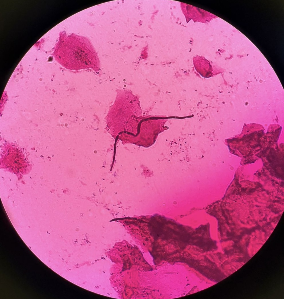 Microscopia com células epiteliais escamosas