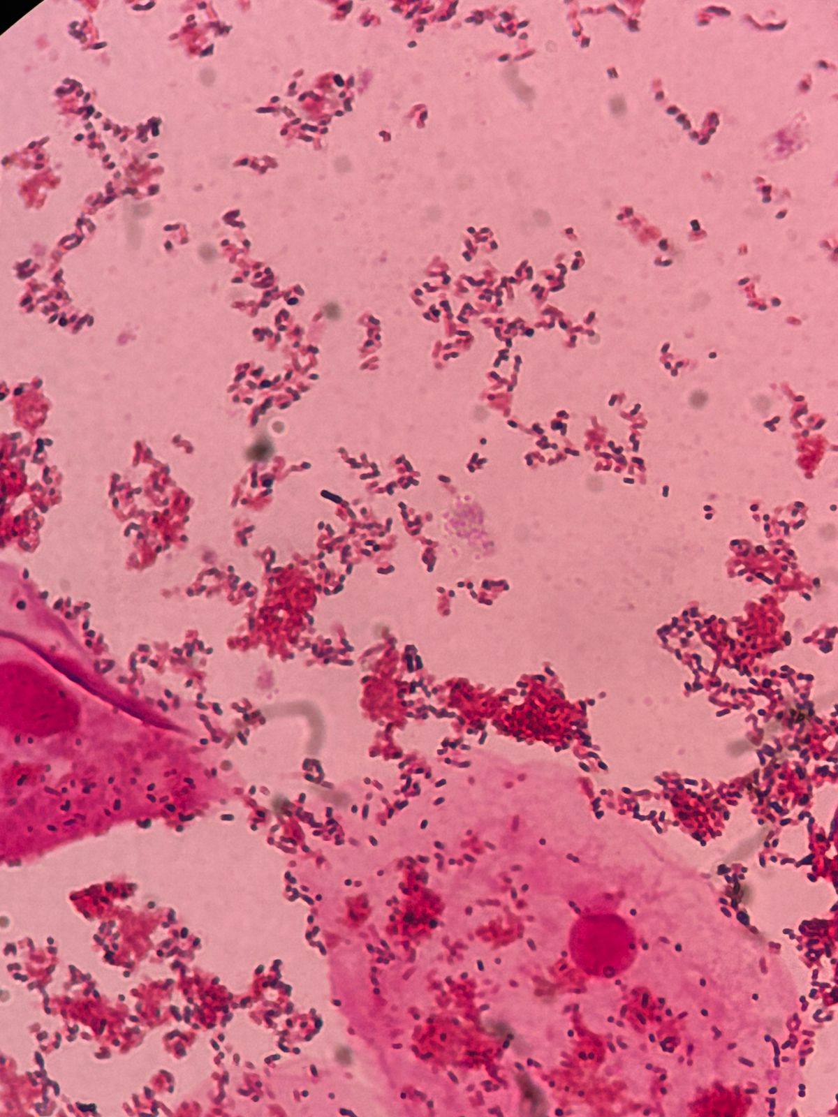 Microscopia com predomínio de bacilos